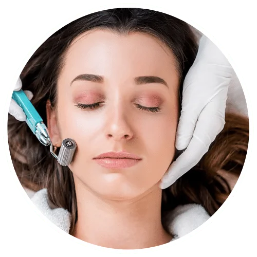 Microneedling Face Treatment